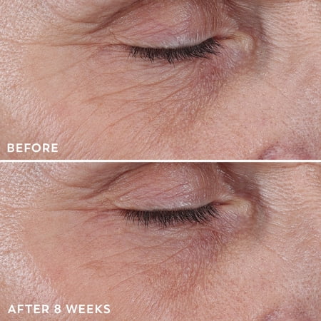 Olay Regenerist crema contorno de ojos 20 ml