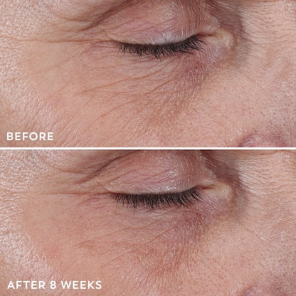 Olay Regenerist crema contorno de ojos 20 ml